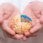 Какие изменения происходят в мозге при болезни Альцгеймера? alzheimer